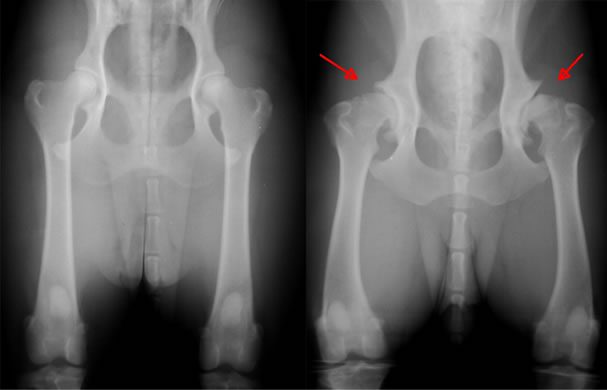 Hip_Dysplasia